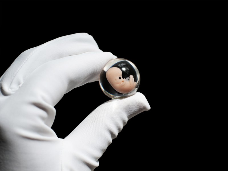 Embryo 7 weeks in Lens, 7 weeks pregnant, Sculpture cast in resin. With Yolk Sac - 公仔/玩偶 - 樹脂 