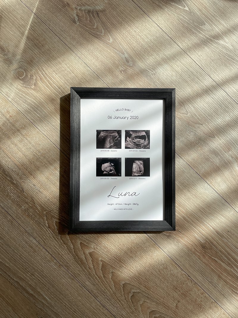Collect touching memories | Ultrasound commemorative paintings - four ultrasounds | Mommy and baby texture record - Other - Paper White