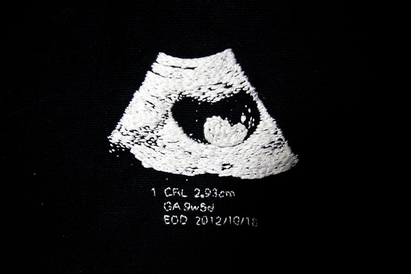 Baby ultrasound embroidery, the moving canvas bag at that time - Wallets - Other Materials 