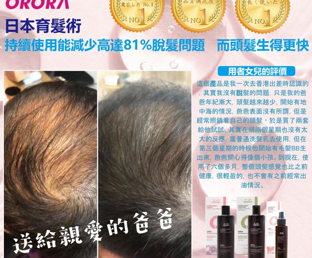 日本ORORA 育毛予防抜け毛シャンプー 300ml - ショップ 株式會社