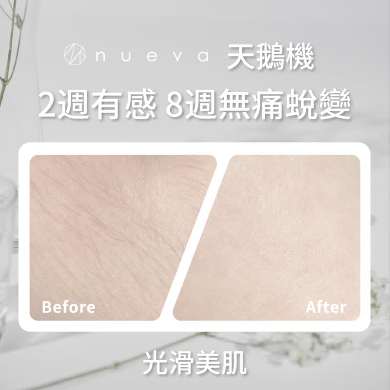 Swan 天鵝Pro除毛嫩膚儀-超值兩入 - 臉部清潔/洗面乳/卸妝 - 其他材質 
